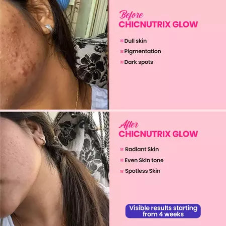Glow – Glutathione Tablets